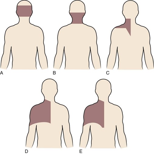 Cervical scapulohumeral syndrome